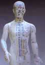 acupuncture model